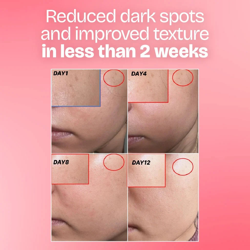 Glow Combo — Serum + Moisturizer