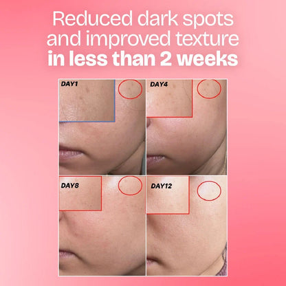 Glow Combo — Serum + Moisturizer