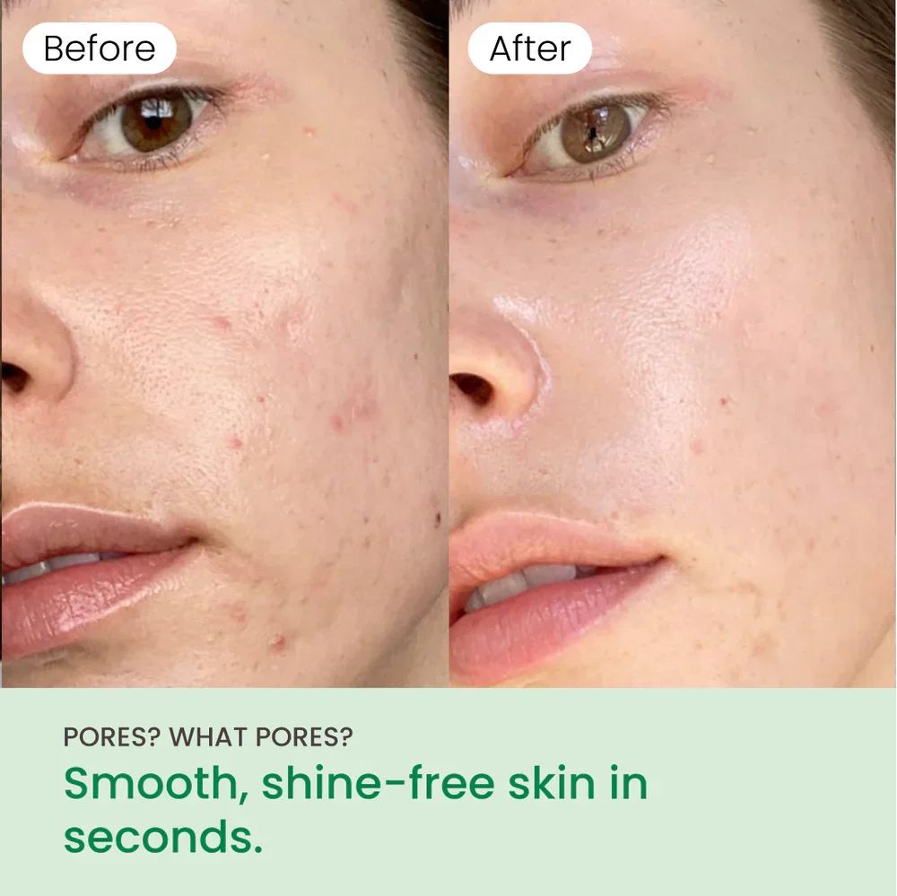 No More Pore Pads